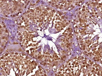MSH5 Rabbit Polyclonal Antibody
