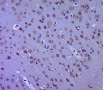 MTHFSD Rabbit Polyclonal Antibody