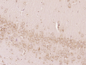 MTMR7 Rabbit Polyclonal Antibody