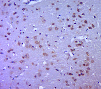 MTX1 Rabbit Polyclonal Antibody