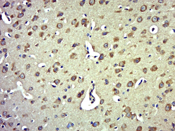 MTX3 Rabbit Polyclonal Antibody