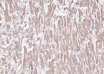 MYL2 Rabbit Polyclonal Antibody