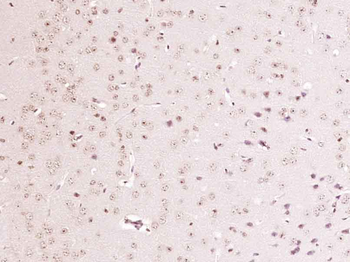 MAB21L1 Rabbit Polyclonal Antibody
