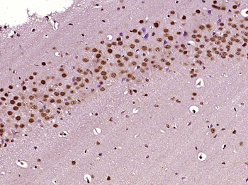 MAK16/RBM13 Rabbit Polyclonal Antibody