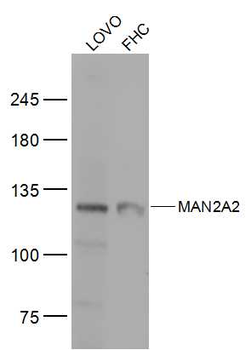 MAN2A2 Rabbit Polyclonal Antibody