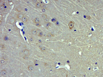 MAN2B1 Rabbit Polyclonal Antibody