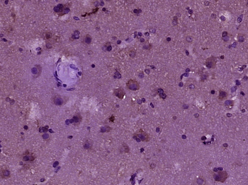 MAP1D Rabbit Polyclonal Antibody