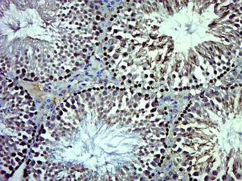MAP1S Rabbit Polyclonal Antibody