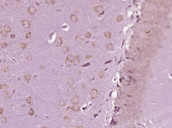 MAP3K6/ASK2 Rabbit Polyclonal Antibody