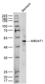 MBOAT1 Rabbit Polyclonal Antibody