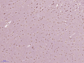 MBTD1 Rabbit Polyclonal Antibody