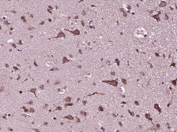 MCART1 Rabbit Polyclonal Antibody