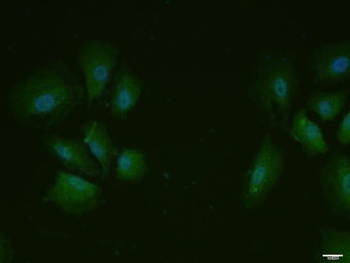 MCL1 (phospho-Ser159) antibody
