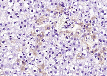 MTP18 Rabbit Polyclonal Antibody