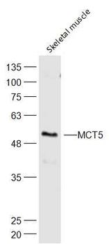 MCT5 Rabbit Polyclonal Antibody