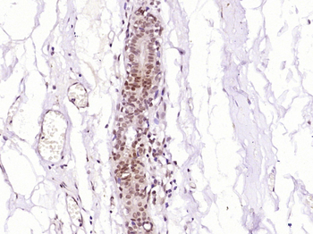 MDFI Rabbit Polyclonal Antibody