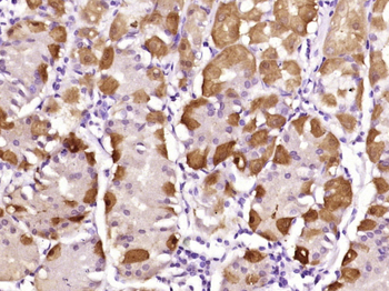 MDFI Rabbit Polyclonal Antibody