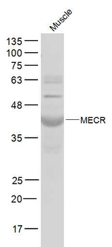 MECR Rabbit Polyclonal Antibody