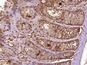 MED18 Rabbit Polyclonal Antibody