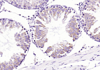 MetAP1 Rabbit Polyclonal Antibody