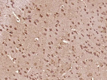 MEX3C Rabbit Polyclonal Antibody