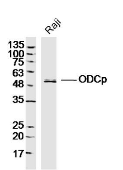 ODCp Rabbit Polyclonal Antibody