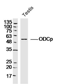 ODCp Rabbit Polyclonal Antibody
