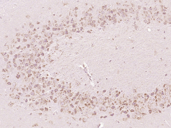 OSBPL11 Rabbit Polyclonal Antibody