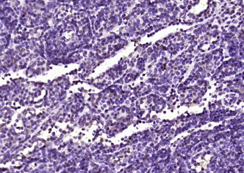 OSBPL3 Rabbit Polyclonal Antibody