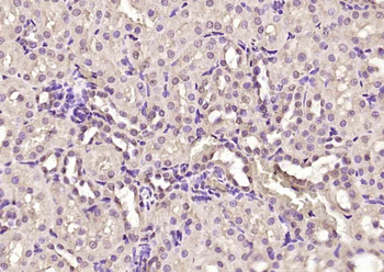 OSBPL3 Rabbit Polyclonal Antibody