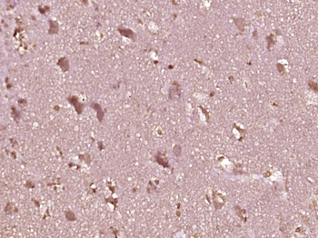 OSBPL7 Rabbit Polyclonal Antibody