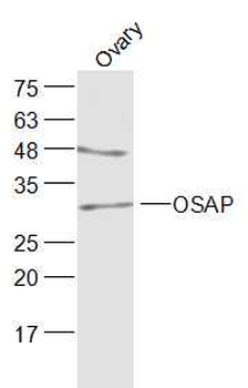 OSAP/Ovary-specific acidic protein Rabbit Polyclonal Antibody