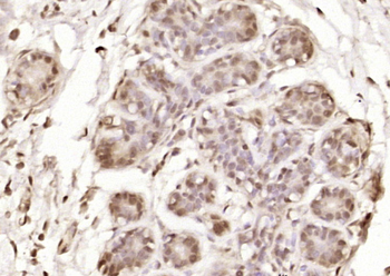OGDH Rabbit Polyclonal Antibody
