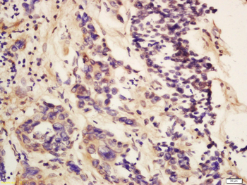 PMS2 Rabbit Polyclonal Antibody