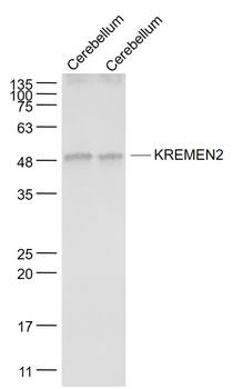 KREMEN2 Rabbit Polyclonal Antibody