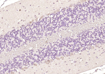 PIK3R5 Rabbit Polyclonal Antibody