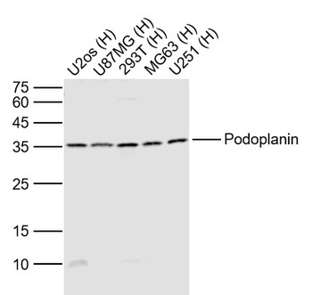 Podoplanin antibody