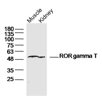 ROR gamma T Rabbit Polyclonal Antibody