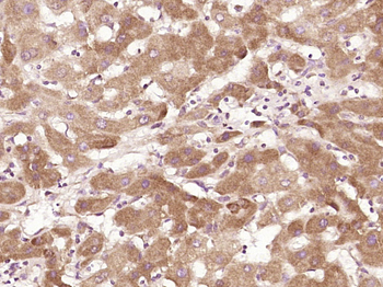 RSPH6A Rabbit Polyclonal Antibody