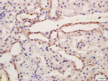 NALP6 Rabbit Polyclonal Antibody
