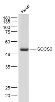 SOCS6 antibody