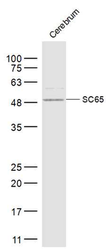 SC65 Rabbit Polyclonal Antibody