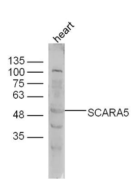 SCARA5 Rabbit Polyclonal Antibody