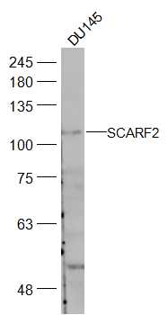 SCARF2 Rabbit Polyclonal Antibody