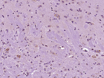 SCFD2 Rabbit Polyclonal Antibody