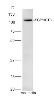 SCP1/CT8 Rabbit Polyclonal Antibody