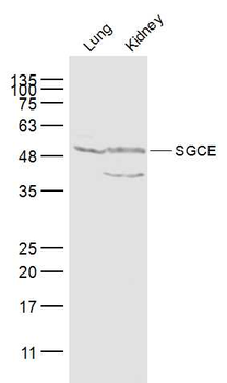 SGCE Rabbit Polyclonal Antibody