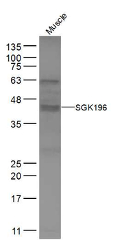 SGK196 Rabbit Polyclonal Antibody