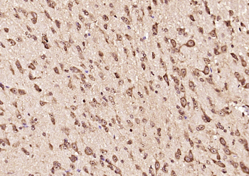 SGK2 Rabbit Polyclonal Antibody