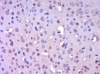 SPEF1 Rabbit Polyclonal Antibody